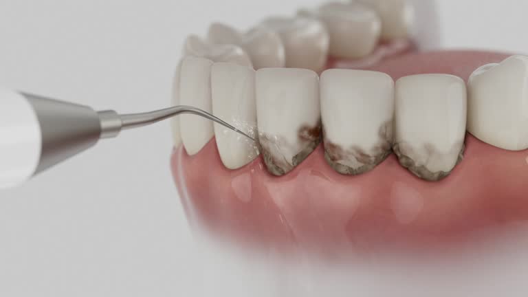 Reliable Dental Implants contractor in Lapeer, MI by Smile Center Dentistry